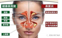 武當(dāng)派《太和門(mén)》秘傳《鼻炎養(yǎng)生導(dǎo)引術(shù)